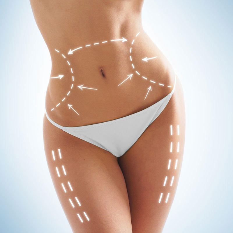 Slim your figure thanks to Cryolipolyse Docteur Santini Chirurgien esthétique Paris