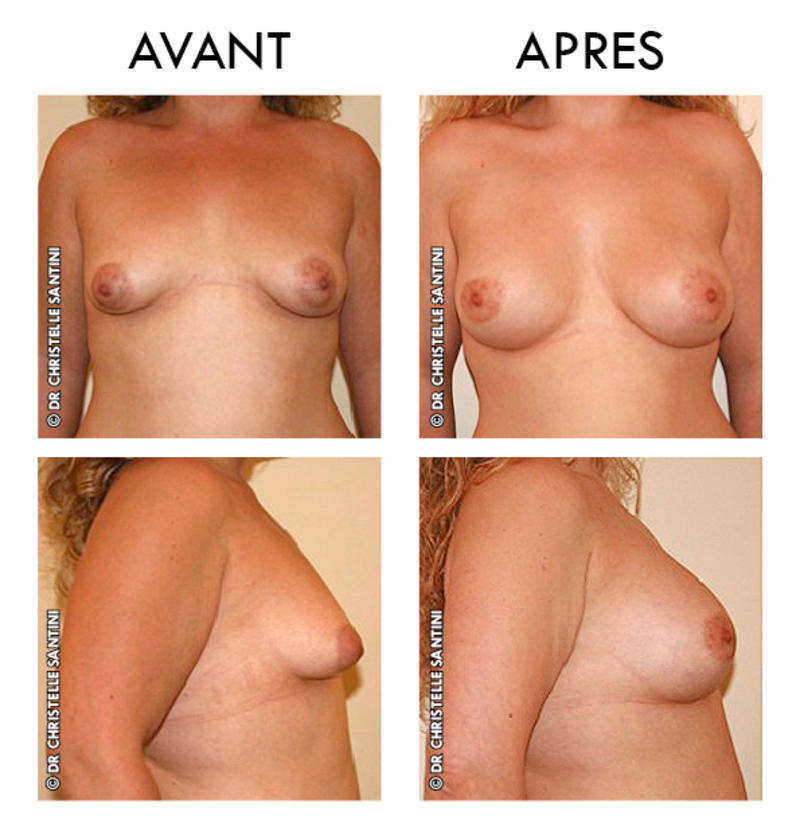 Docteur Santini Chirurgien esthétique Paris