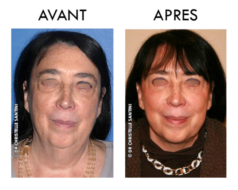 Docteur Santini Chirurgien esthétique Paris