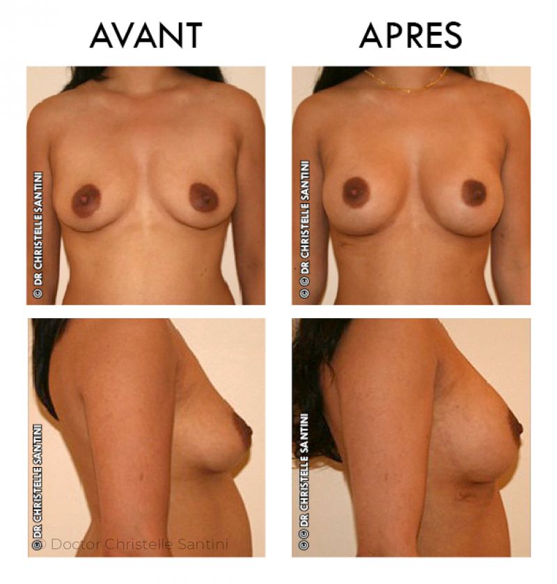 Docteur Santini Chirurgien esthétique Paris