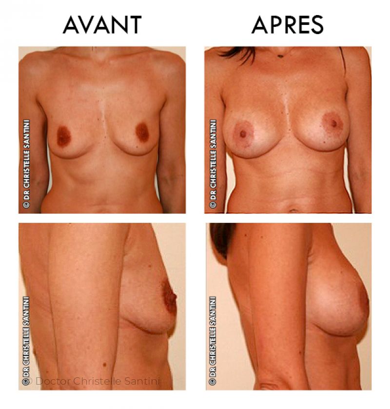 Docteur Santini Chirurgien esthétique Paris