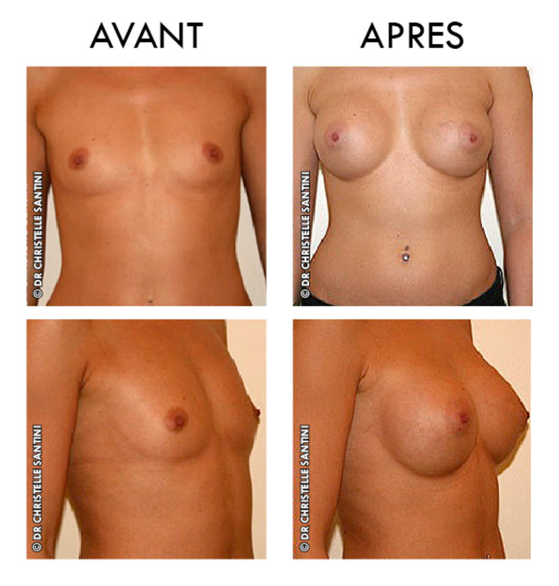 Docteur Santini Chirurgien esthétique Paris