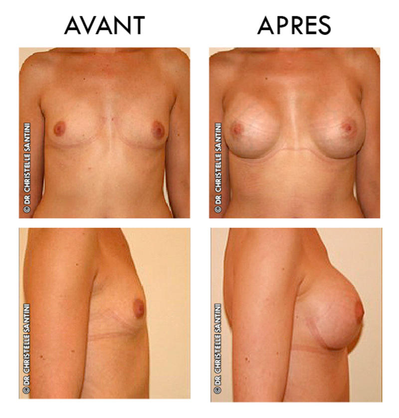Docteur Santini Chirurgien esthétique Paris
